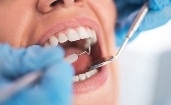 Tandkirurgi – mere omstændige forhold